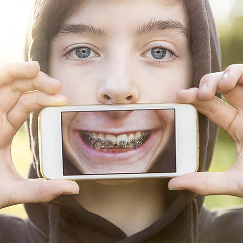 Virtual Appointments & Dental Monitoring - Gulfport & Laurel MS - Smile Country Orthodontics