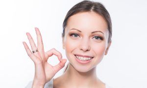12 Things You Should Know Before Getting Braces